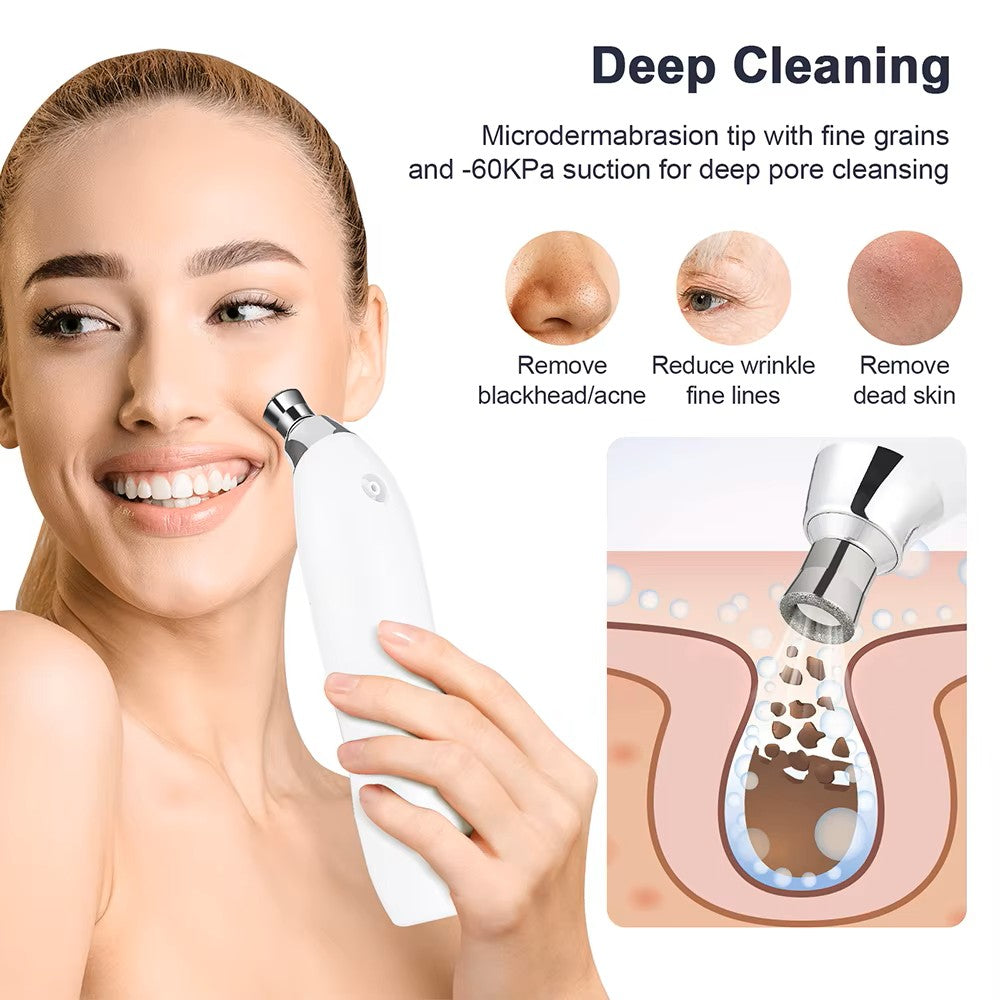 Portable Diamond Microdermabrasion Facial Peeling Machine - Deep Cleaning Vacuum Blackhead Remover - For Exfoliation & Skin Rejuvenation