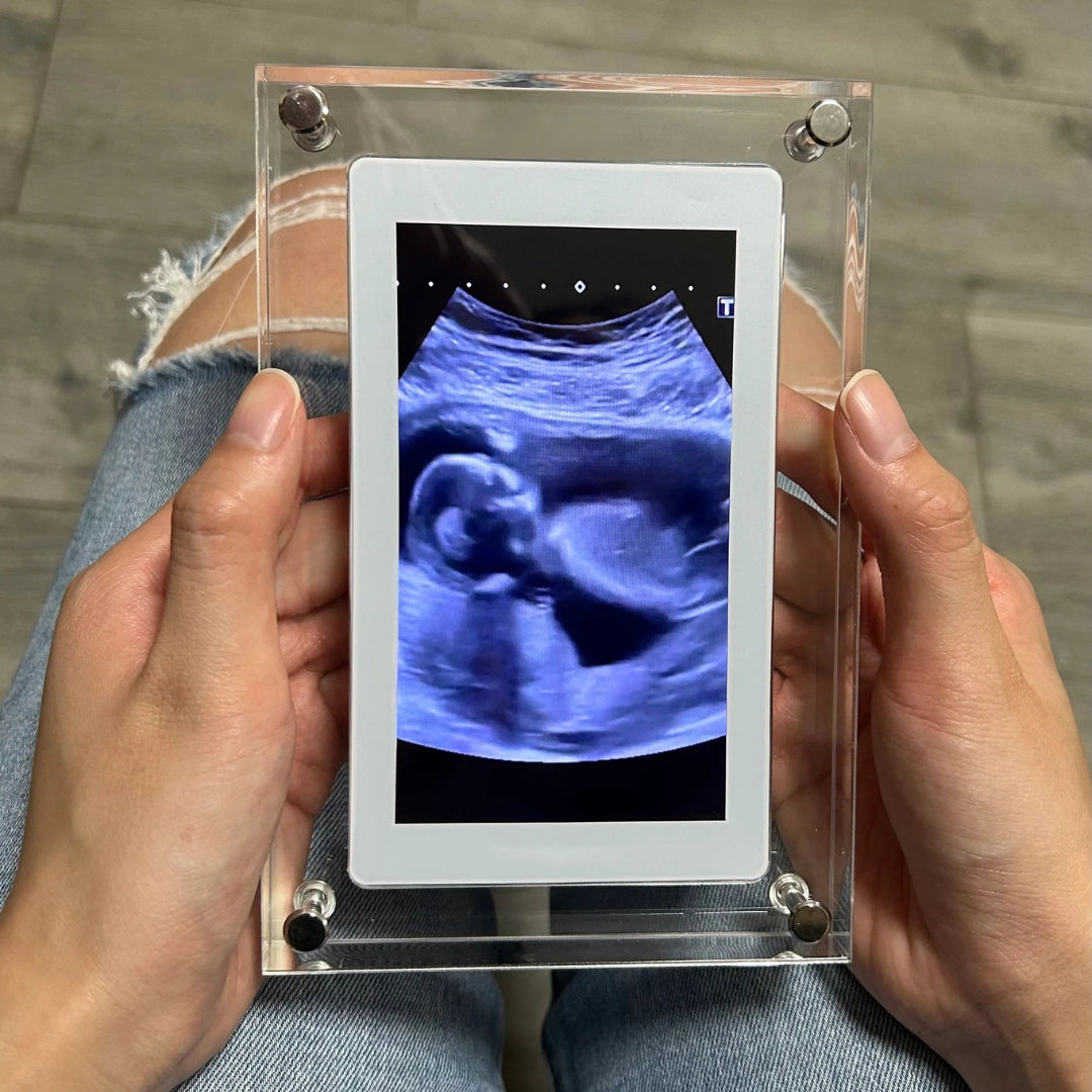 LumiFrame™ Digital Memory Frame