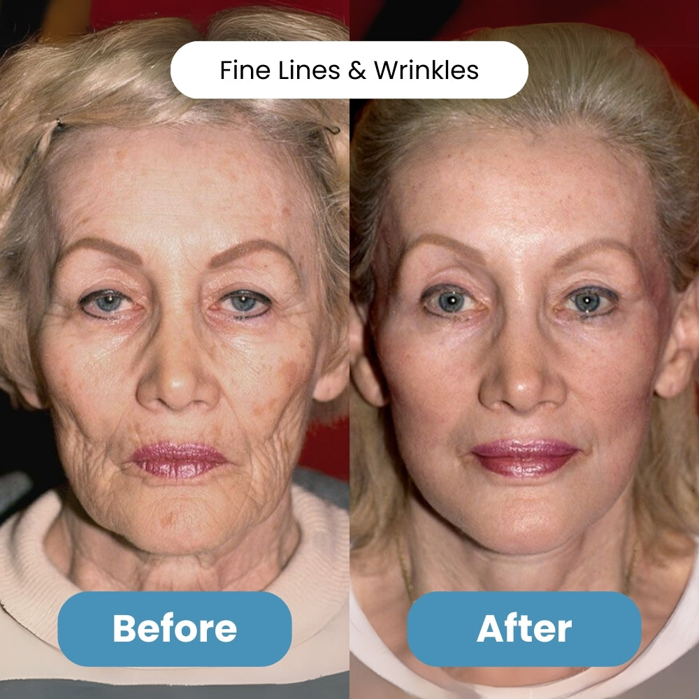 Milluva™ 3% Hyaluronic Acid Serum