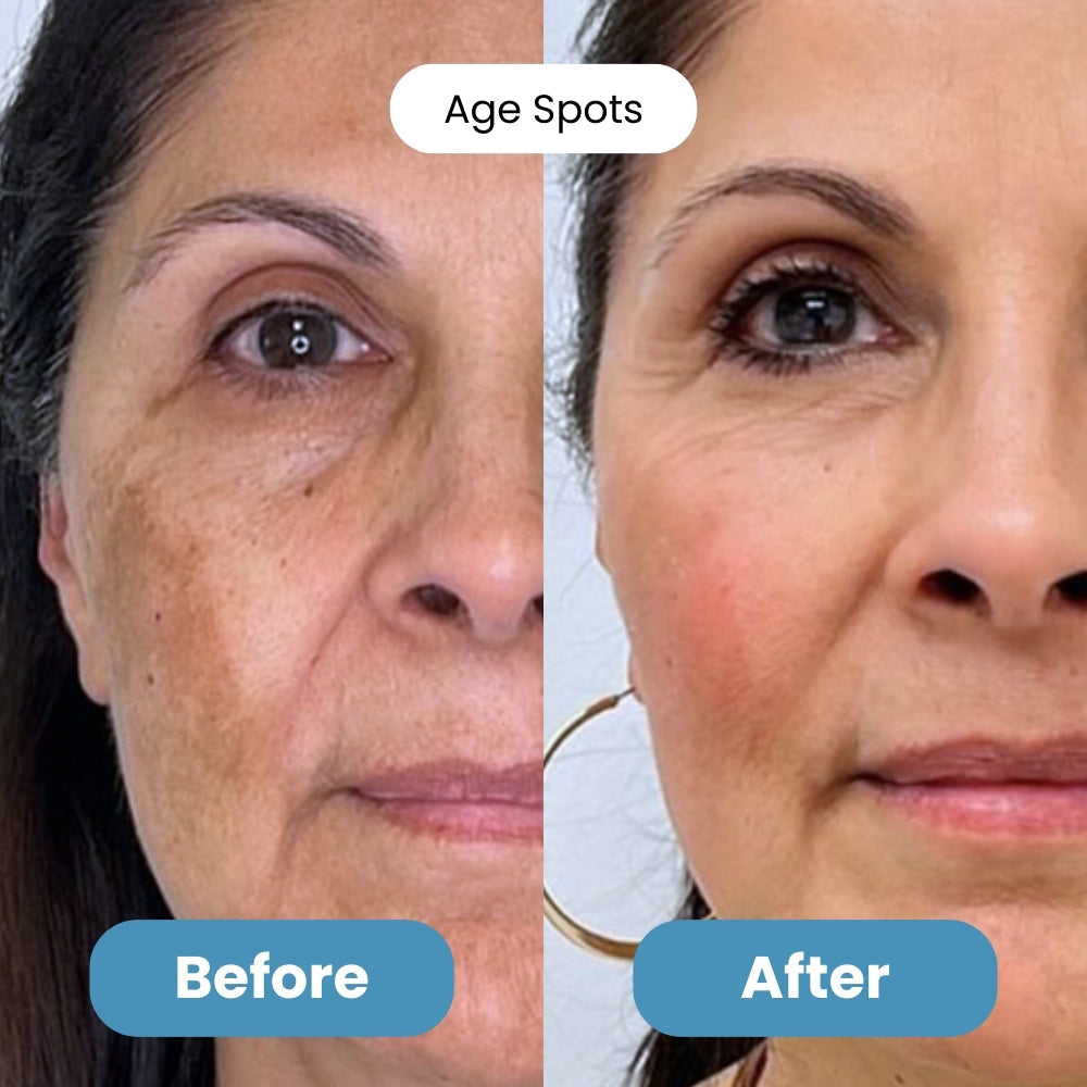 Milluva™ 3% Hyaluronic Acid Serum