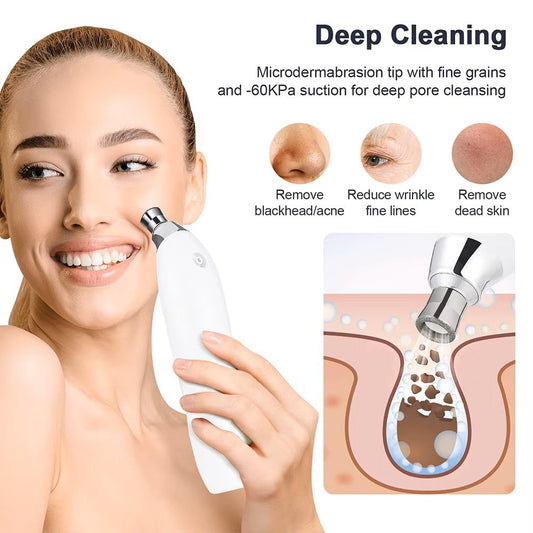 Portable Diamond Microdermabrasion Facial Peeling Machine - Deep Cleaning Vacuum Blackhead Remover - For Exfoliation & Skin Rejuvenation