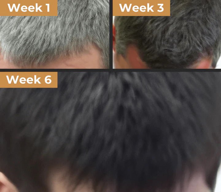 Real customer hairline photos at Week 1, Week 3 and Week 6 of using the Pomence Gray Hair Soap Bar