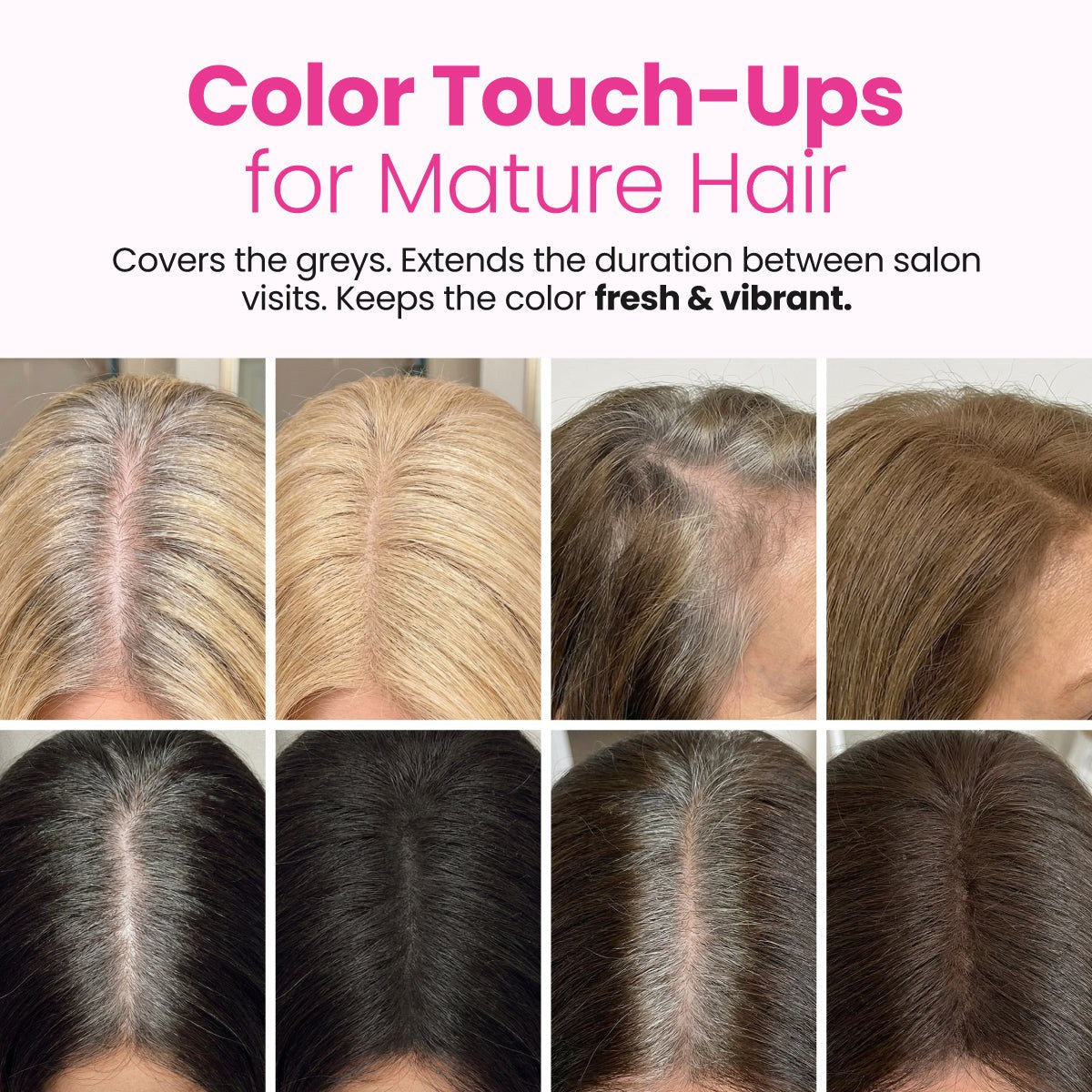 Eight scalp views before and after, several shades